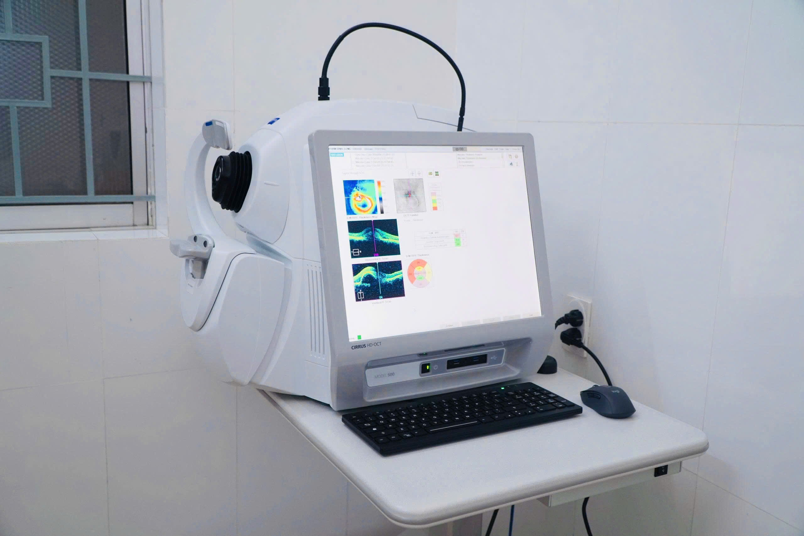 BƯỚC TIẾN MỚI TRONG CHẨN ĐOÁN HÌNH ẢNH CÁC BỆNH LÝ VỀ MẮT TẠI BỆNH VIỆN ĐA KHOA TỈNH...