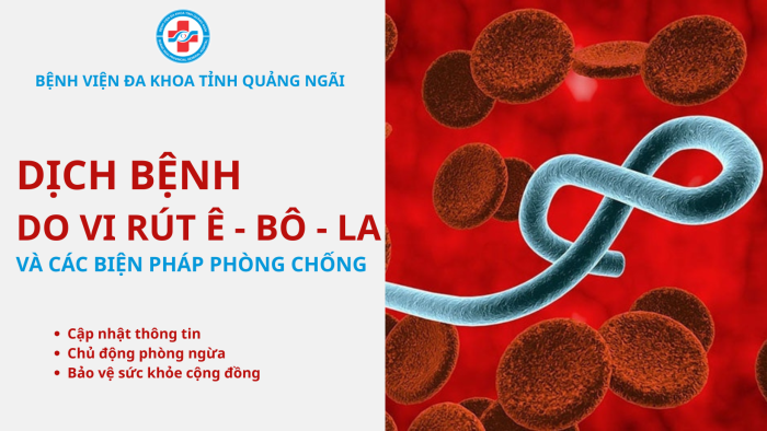 DỊCH BỆNH DO VI RÚT Ê – BÔ – LA VÀ CÁC BIỆN PHÁP PHÒNG CHỐNG
