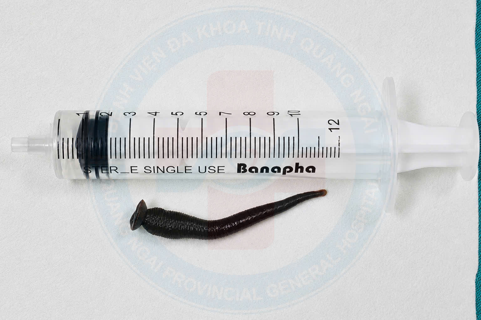 GẮP THÀNH CÔNG CON ĐỈA SUỐI DÀI 5 CM BÁM TRONG KHÍ QUẢN NGƯỜI BỆNH